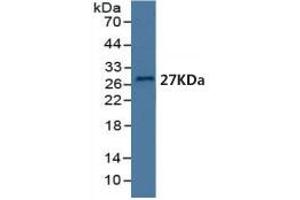 Mouse Capture antibody from the kit in WB with Positive Control: Human serum. (BDNF ELISA Kit)