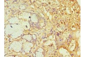 Immunohistochemistry of paraffin-embedded human gallbladder tissue using ABIN7144783 at dilution of 1:100 (Ataxin 1 antibody  (AA 586-815))