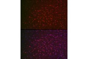 Immunofluorescence (IF) image for anti-Nuclear Receptor Subfamily 5, Group A, Member 2 (NR5A2) (AA 1-140) antibody (ABIN6144832)