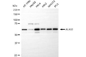 anti-Aminolevulinate, delta-, Synthase 2 (ALAS2) antibody