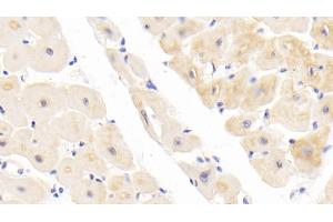 Detection of ROR1 in Human Cardiac Muscle Tissue using Polyclonal Antibody to Receptor Tyrosine Kinase Like Orphan Receptor 1 (ROR1) (ROR1 antibody  (AA 540-795))