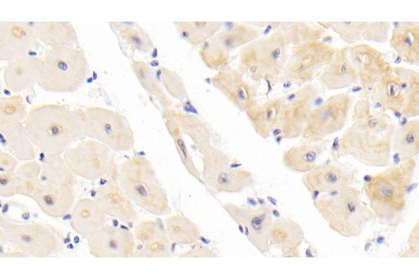 ROR1 antibody  (AA 540-795)