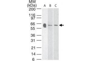 Western blot analysis of Htr3a in A) human, B) mouse and C) rat brain tissue lysate using Htr3a polyclonal antibody  at 3 ug/mL .