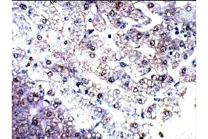 Detecting C4a in Baboon Kidney using ABIN2749472 (C4A antibody  (AA 1220-1270))