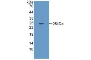 Detection of Recombinant XCR1, Mouse using Polyclonal Antibody to Chemokine C-Motif Receptor 1 (XCR1) (XCR1 antibody  (AA 244-322))