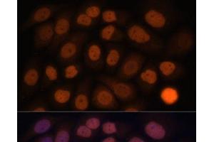 Immunofluorescence analysis of HeLa cells using KLF6 Polyclonal Antibody at dilution of 1:100. (KLF6 antibody)