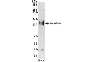 Western Blotting (WB) image for anti-Nicastrin (NCSTN) (AA 659-709) antibody (ABIN7451011)
