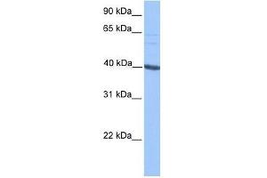 MLLT3 antibody used at 0. (AF9 antibody  (C-Term))