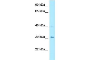 WB Suggested Anti-CA7 Antibody Titration: 1.