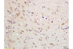 Formalin-fixed and paraffin embedded rat brain tissue labeled with Anti-ChRM1/Acetylcholine receptor(M1) Polyclonal Antibody, Unconjugated  at 1:200 followed by conjugation to the secondary antibody, (SP-0023), and DAB staining (CHRM1 antibody  (AA 321-420))