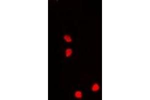 Immunofluorescent analysis of Nucleostemin staining in A549 cells. (Nucleostemin antibody)