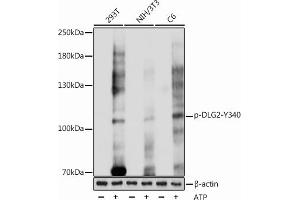 Western blot analysis of extracts of various cell lines, using Phospho-PSD93/chapsyn-110/DLG2-Y340 antibody (ABIN7266792) at 1:1000 dilution. (DLG2 antibody  (pTyr340))