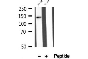Western blot analysis of extracts of K-562 cells, using MLXIP antibody.