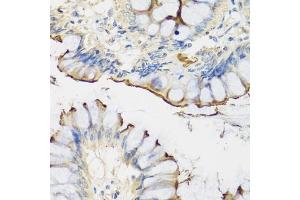 Immunohistochemistry of paraffin-embedded human colon using CRTAP antibody (ABIN1679366, ABIN3018913, ABIN3018914 and ABIN6220627) at dilution of 1:100 (40x lens). (CRTAP antibody  (AA 20-240))