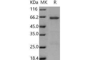 Western Blotting (WB) image for Tribbles Homolog 3 (Drosophila) (TRIB3) protein (GST tag) (ABIN7198334) (TRIB3 Protein (GST tag))