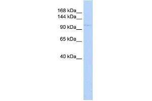 WB Suggested Anti-ZBTB11 Antibody Titration:  0. (ZBTB11 antibody  (N-Term))