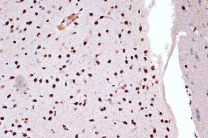 Immunohistochemistry of paraffin-embedded rat brain using FUBP1 Rabbit mAb (ABIN7267128) at dilution of 1:100 (40x lens). (FUBP1 antibody)
