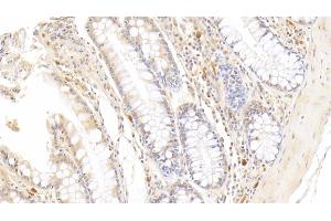 Detection of RNASE2 in Human Colon Tissue using Monoclonal Antibody to Ribonuclease A2 (RNASE2) (RNASE2 antibody  (AA 28-161))