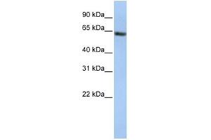 FANCE antibody used at 1 ug/ml to detect target protein. (FANCE antibody  (Middle Region))