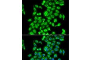 Immunofluorescence analysis of MCF7 cells using COPS3 Polyclonal Antibody (COPS3 antibody)