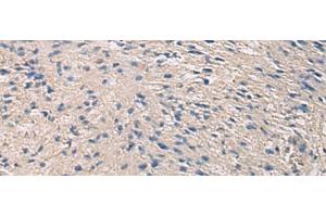 Immunohistochemistry of paraffin-embedded Human brain tissue using PRKCSH Polyclonal Antibody at dilution of 1:90(x200) (PRKCSH antibody)
