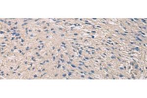 Immunohistochemistry of paraffin-embedded Human brain tissue using PRKCSH Polyclonal Antibody at dilution of 1:90(x200)