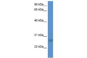 WB Suggested Anti-SPSB2 Antibody Titration: 0.