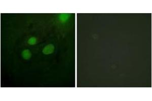 Immunofluorescence (IF) image for anti-Replication Protein A2, 32kDa (RPA2) (AA 10-59) antibody (ABIN2888859) (RPA2 antibody  (AA 10-59))