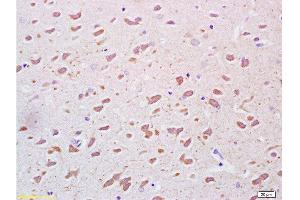 Formalin-fixed and paraffin embedded rat brain tissue labeled Anti-PEGF Polyclonal Antibody, Unconjugated  at 1:200, followed by conjugation to the secondary antibody and DAB staining (PEDF antibody  (AA 201-300))