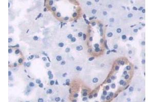 DAB staining on IHC-P; Samples: Rat Kidney Tissue (PIM1 antibody  (AA 38-177))