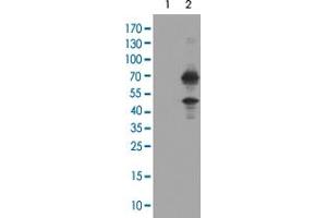 Western Blot analysis of HEK293T cells (Lane 1: transfected with pCMV6-ENTRY control and Lane 2: transfected with pCMV6-ENTRY TRMT2A cDNA) with TRMT2A monoclonal antibody, clone 1G8 . (TRMT2A antibody)