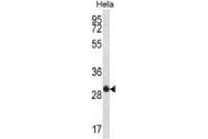 WFDC1 Antibody (C-term H163) western blot analysis in Hela cell line lysates (35 µg/lane). (WFDC1 antibody  (C-Term, His163))