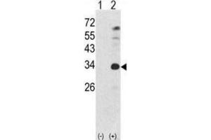 Western Blotting (WB) image for anti-Nanog Homeobox (NANOG) antibody (ABIN2998310) (Nanog antibody)