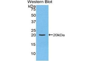 Western Blotting (WB) image for anti-Coagulation Factor II (thrombin) (F2) (AA 44-200) antibody (ABIN1858444)