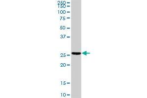 TNNI2 MaxPab rabbit polyclonal antibody. (TNNI2 antibody  (AA 1-182))