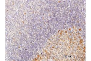 Immunoperoxidase of purified MaxPab antibody to C10orf7 on formalin-fixed paraffin-embedded human tonsil. (CDC123 antibody  (AA 1-336))