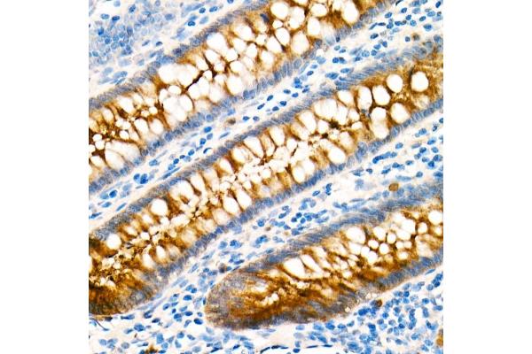 CEACAM5 antibody
