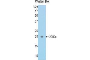 Detection of Recombinant TNC, Rat using Polyclonal Antibody to Tenascin C (TNC) (TNC antibody  (AA 175-342))