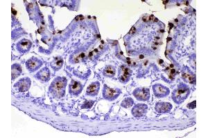 IHC analysis of TFF3 using anti-TFF3 antibody . (TFF3 antibody  (AA 23-81))