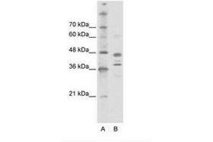 Image no. 1 for anti-SWI/SNF Related, Matrix Associated, Actin Dependent Regulator of Chromatin, Subfamily B, Member 1 (SMARCB1) (AA 212-261) antibody (ABIN6736126) (SMARCB1 antibody  (AA 212-261))