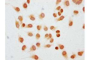 Immunocytochemistry analysis of ABIN7139280 diluted at 1:10 and staining in Hela cells performed on a Leica BondTM system. (HIST1H1C antibody  (2meLys45))