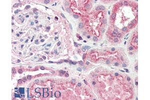ABIN190757 (5µg/ml) staining of paraffin embedded Human Kidney. (OGG1 antibody  (Internal Region))