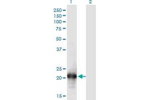 Western Blot analysis of HN1L expression in transfected 293T cell line by HN1L monoclonal antibody (M05), clone 1G8. (HN1L antibody  (AA 1-190))
