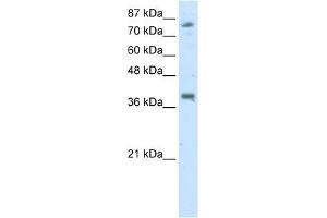 WB Suggested Anti-TSC22D2 Antibody Titration:  2. (TSC22D2 antibody  (C-Term))