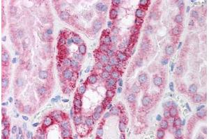 Immunohistochemistry (Paraffin-embedded Sections) (IHC (p)) image for anti-Polymerase (RNA) II (DNA Directed) Polypeptide B, 140kDa (POLR2B) (AA 805-854) antibody (ABIN6736747)