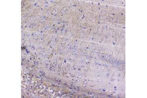 IHC analysis of Betacellulin using anti-Betacellulin antibody . (Betacellulin antibody  (AA 32-177))
