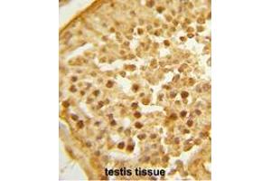 Formalin-fixed and paraffin-embedded human testis tissue reacted with BAHD1 Antibody (C-term), which was peroxidase-conjugated to the secondary antibody, followed by DAB staining. (BAHD1 antibody  (C-Term))