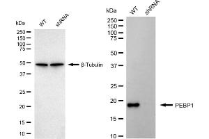 Western blotting analysis using PEBP1 antibody (ABIN7799790).