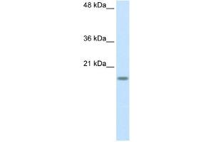 WB Suggested Anti-RPS14 Antibody Titration:  2. (RPS14 antibody  (Middle Region))