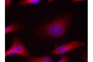 Immunofluorescence staining of methanol-fixed Hela cells using Src(Phospho-Tyr529) Antibody. (Src antibody  (pTyr529))